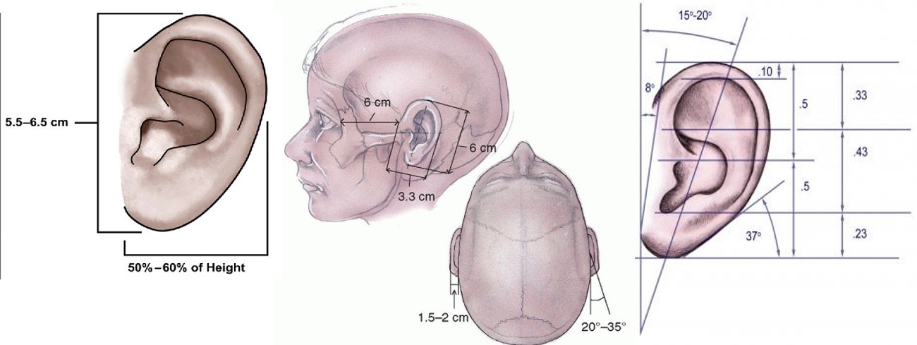 Macrotia1